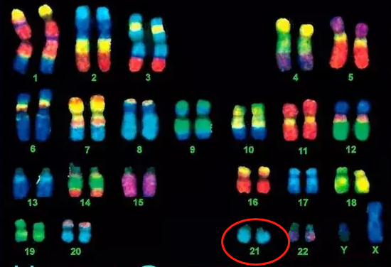 孩子的21号染色体是遗传谁的机会大？