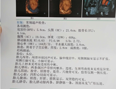 通过四维彩图可以看出胎儿助孕