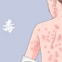 得过梅毒的夫妻做试管婴儿需要开证明吗？