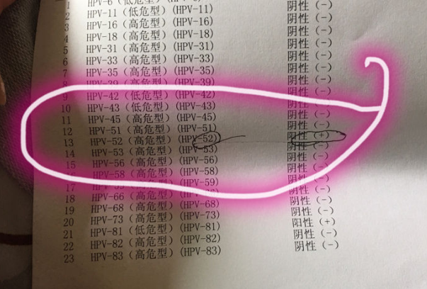 HPV52阳性会影响试管的成功率