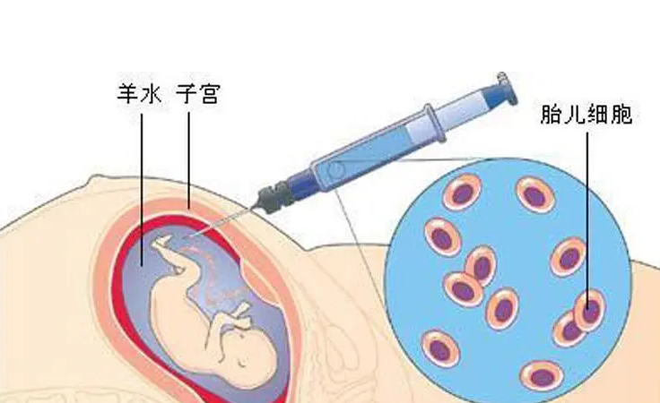 孕妇羊水穿刺做了后办公室坐着上班可以吗？