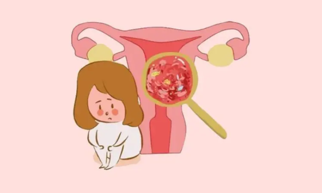 50岁女性患子宫腺肌症治疗