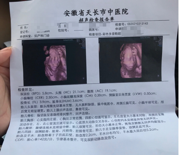 四维彩超报告单