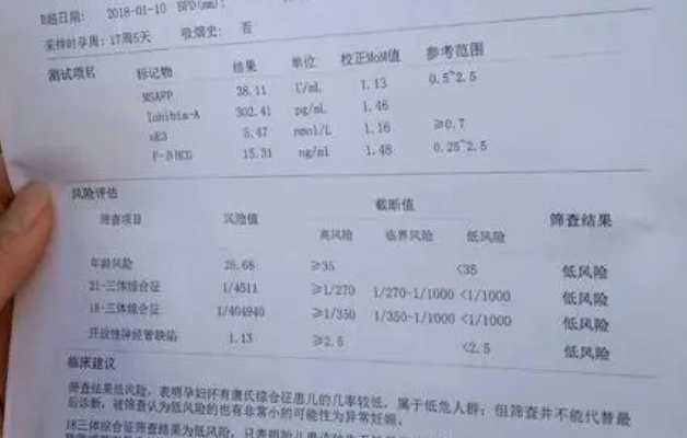 唐氏筛查的mom值都小于1不一定助孕