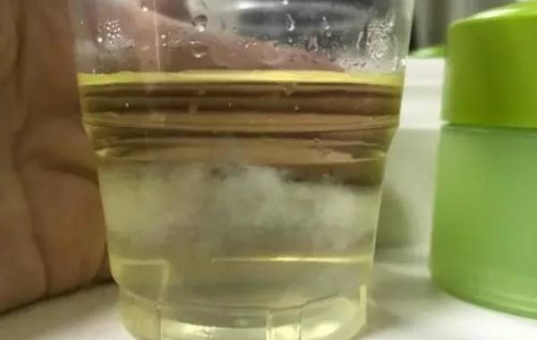 在家用酒精测不出来怀孩子还是女孩