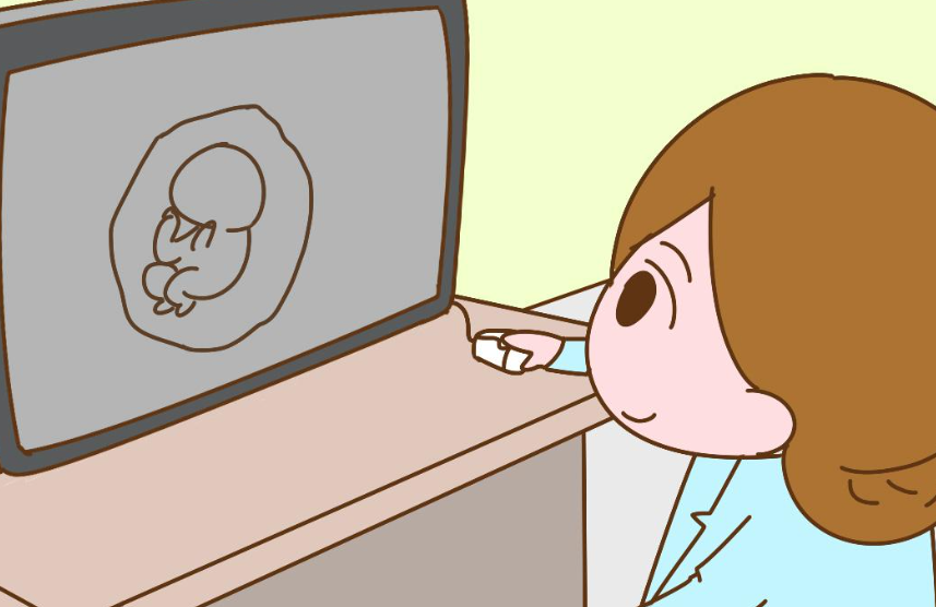 孕中期要做糖耐检查