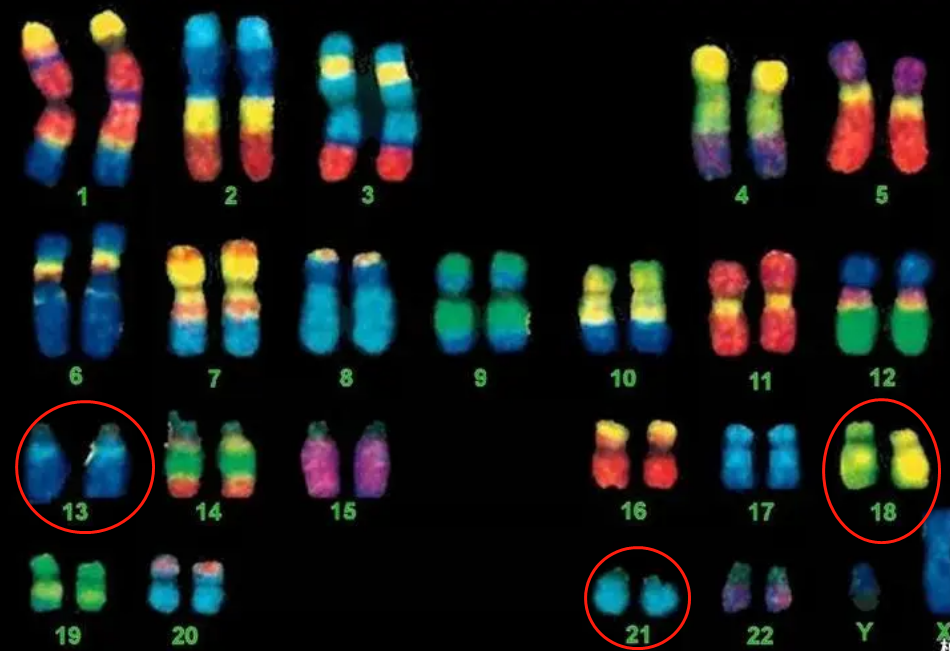 查21号18号13号染色体可以看肚子里的宝宝的助孕吗？