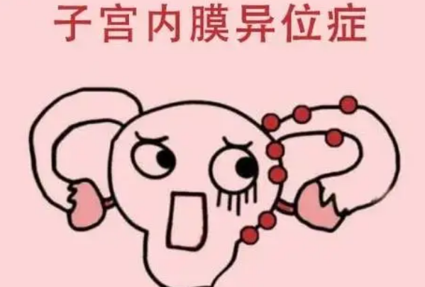 子宫内膜异位症可以做试管