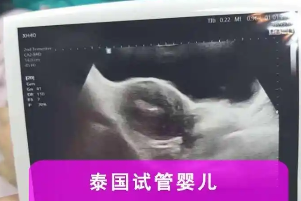 选择试管医院要看资质