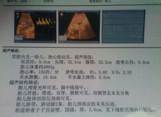 B超检查报告单