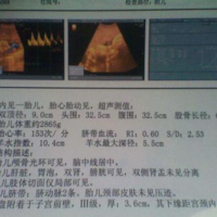 下一篇