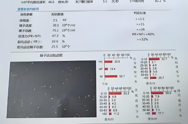 不同试管技术花费存在差异
