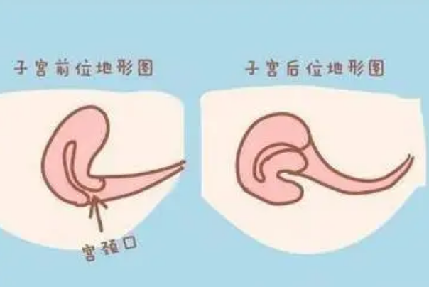 胎儿男女与子宫位置没有关系